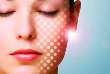 laser non-ablative skin rejuvenation
