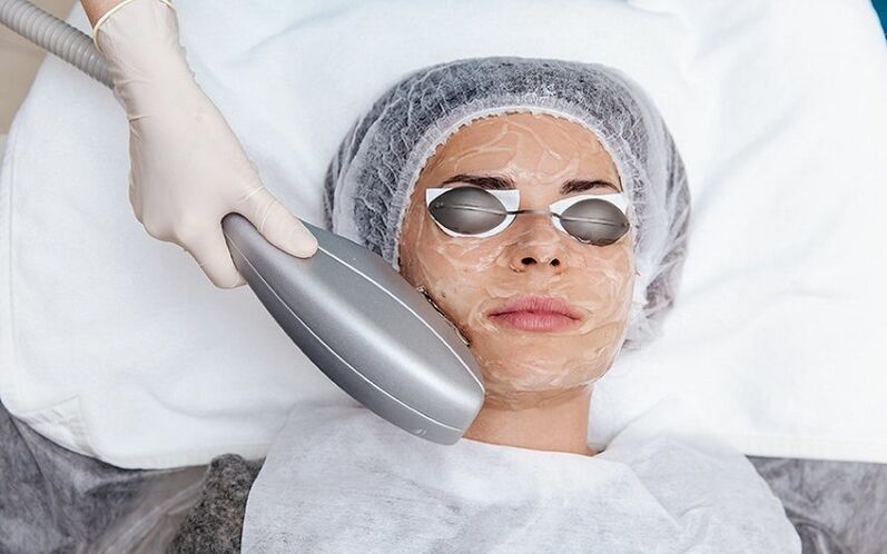 skin photo rejuvenation procedure