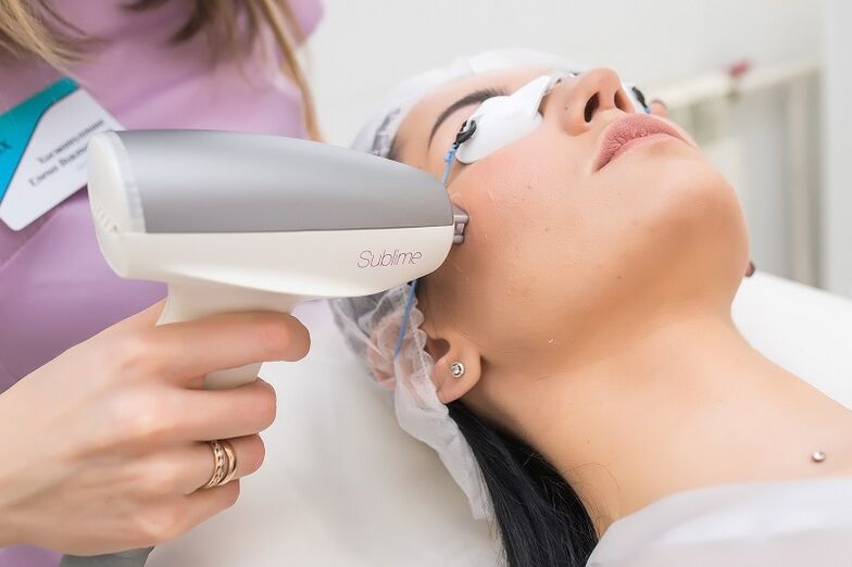 perform a procedure for laser skin rejuvenation
